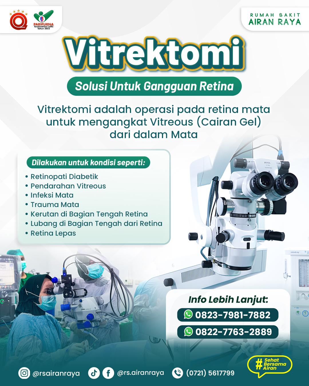 Vitrektomi